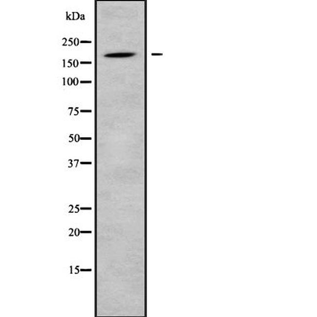 ADAMTS12 Antibody in Western Blot (WB)