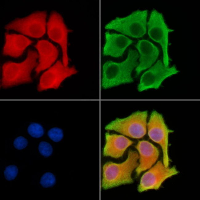 ADAMTS13 Antibody in Immunocytochemistry (ICC/IF)