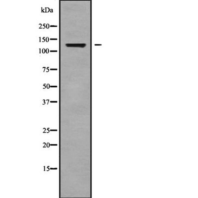 ADAMTS14 Antibody in Western Blot (WB)