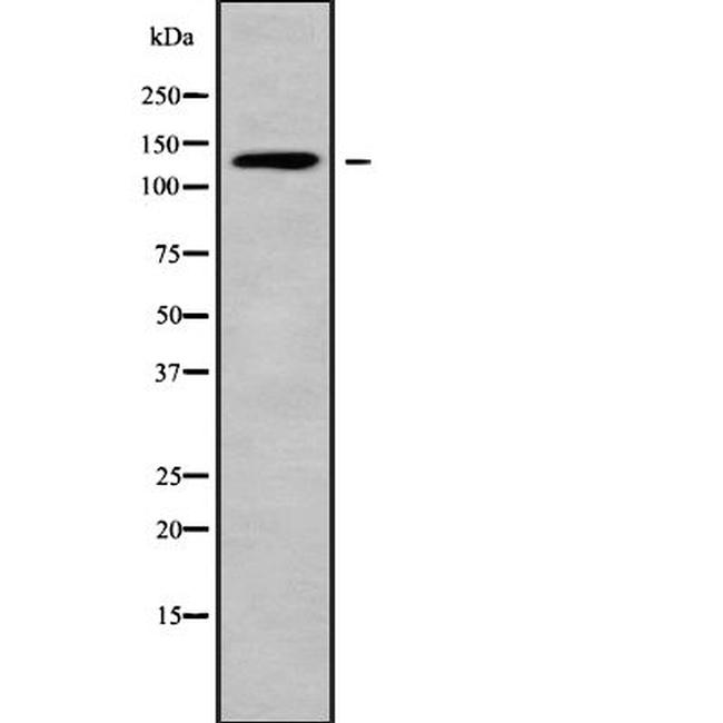 ADAMTS16 Antibody in Western Blot (WB)