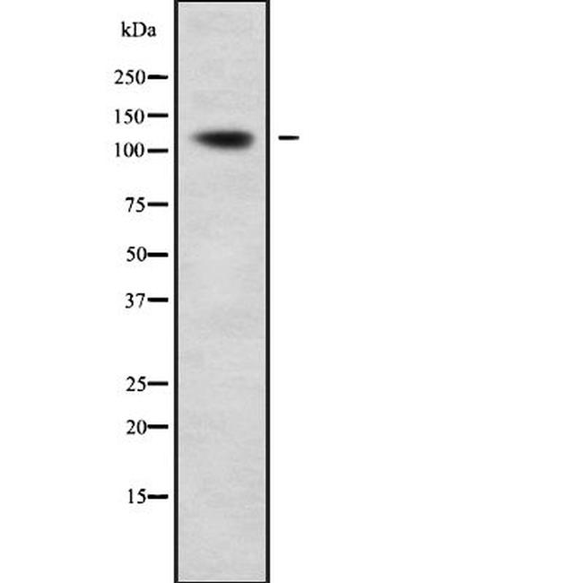 ADAMTS17 Antibody in Western Blot (WB)