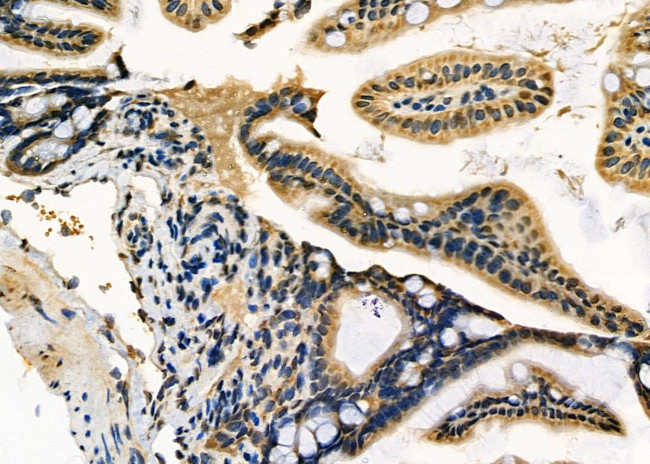 ADAMTS20 Antibody in Immunohistochemistry (Paraffin) (IHC (P))