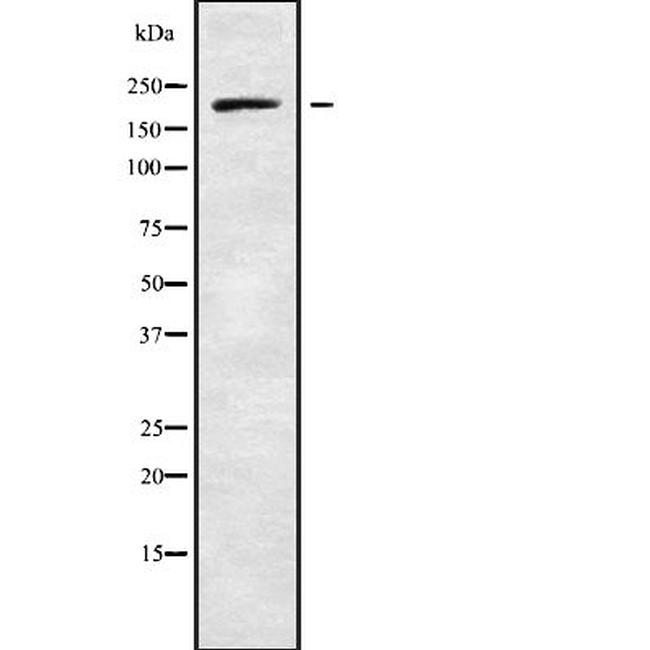 ADAMTS20 Antibody in Western Blot (WB)