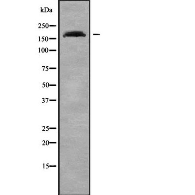 ADAMTS7 Antibody in Western Blot (WB)