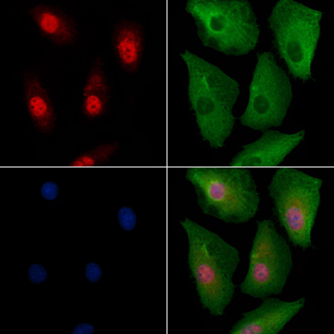 RPP25L Antibody in Immunocytochemistry (ICC/IF)