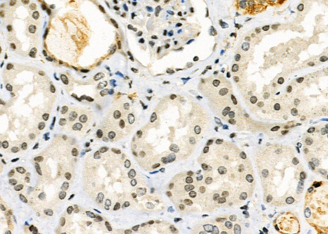 RPP25L Antibody in Immunohistochemistry (Paraffin) (IHC (P))