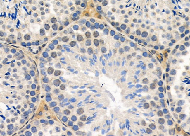 RPP25L Antibody in Immunohistochemistry (Paraffin) (IHC (P))