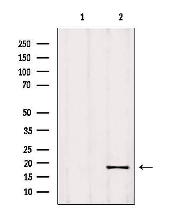 RPP25L Antibody in Western Blot (WB)