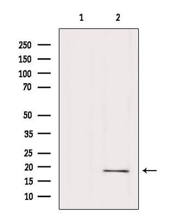 RPP25L Antibody in Western Blot (WB)