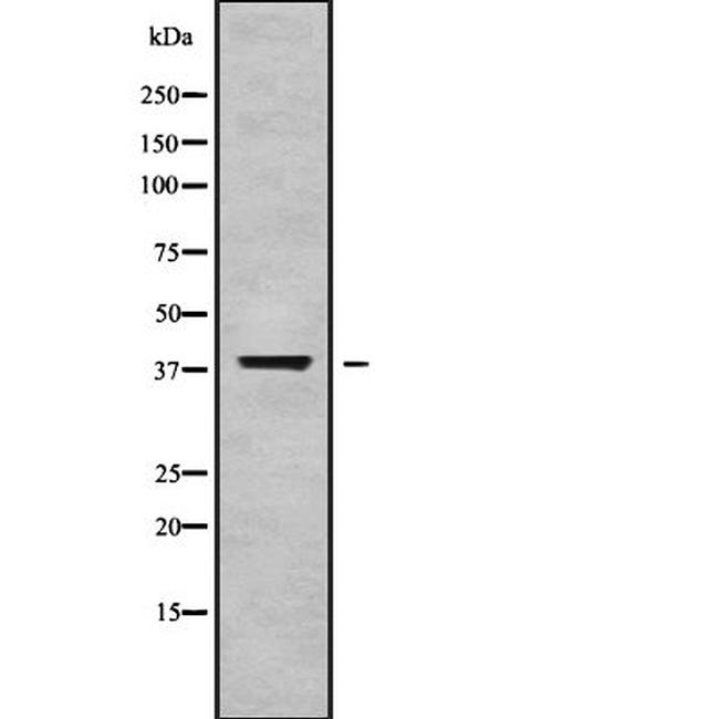 GALM Antibody in Western Blot (WB)