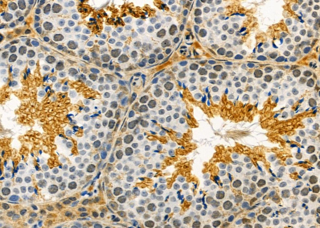 ASAH3 Antibody in Immunohistochemistry (Paraffin) (IHC (P))