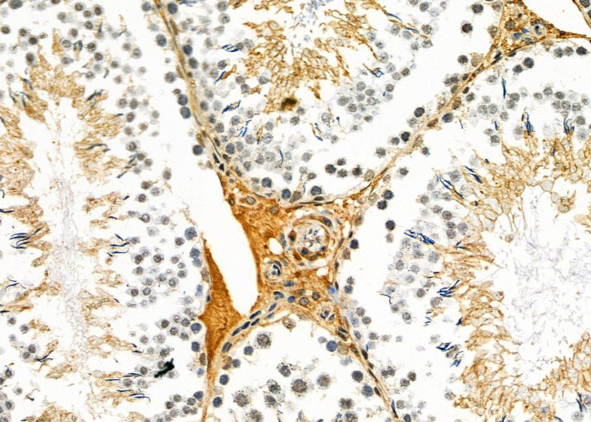 ASAH3 Antibody in Immunohistochemistry (Paraffin) (IHC (P))