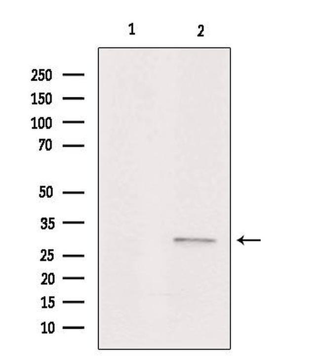 ASAH3 Antibody in Western Blot (WB)