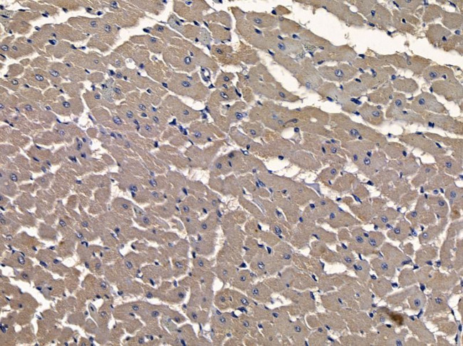 AMOT Antibody in Immunohistochemistry (Paraffin) (IHC (P))