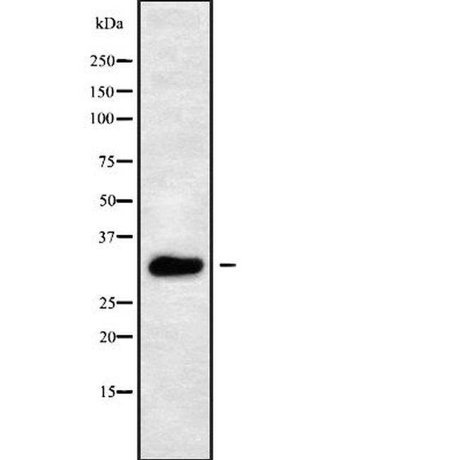 Aquaporin 10 Antibody in Western Blot (WB)
