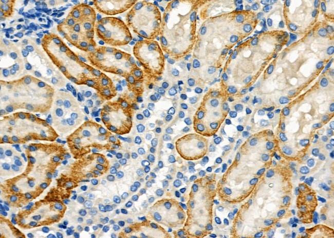 SLC7A10 Antibody in Immunohistochemistry (Paraffin) (IHC (P))