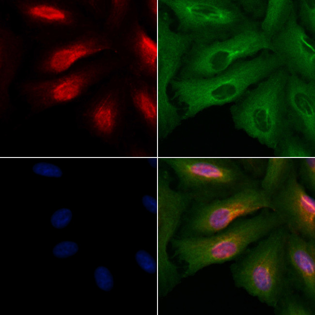 ATXN7L3 Antibody in Immunocytochemistry (ICC/IF)