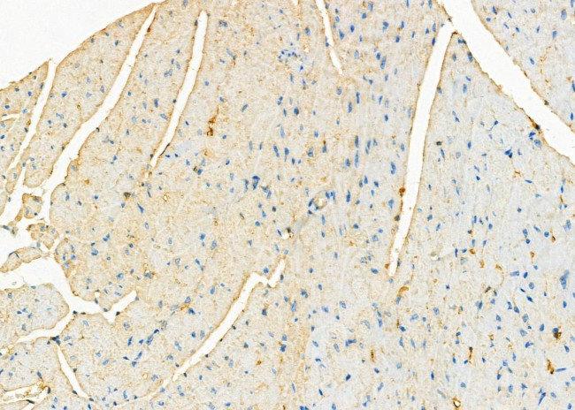 ATP5G1 Antibody in Immunohistochemistry (Paraffin) (IHC (P))