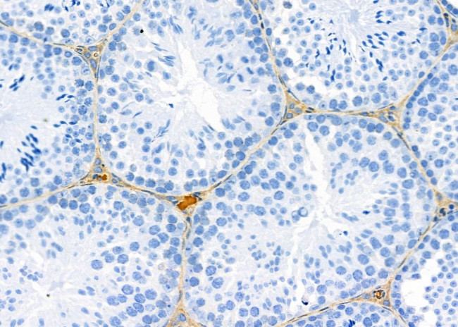 ATP5G1 Antibody in Immunohistochemistry (Paraffin) (IHC (P))