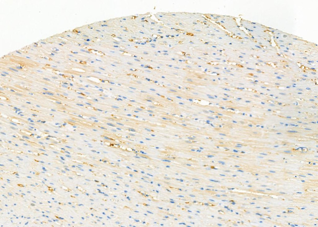 ATP5G1 Antibody in Immunohistochemistry (Paraffin) (IHC (P))