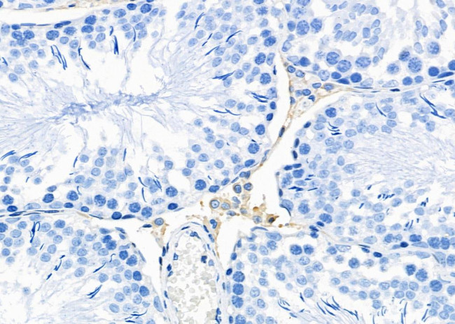 ATP5G1 Antibody in Immunohistochemistry (Paraffin) (IHC (P))