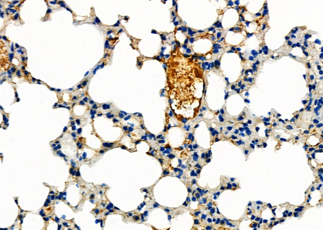 ABCA3 Antibody in Immunohistochemistry (Paraffin) (IHC (P))