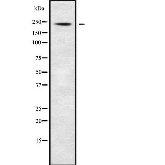 ABCA7 Antibody in Western Blot (WB)