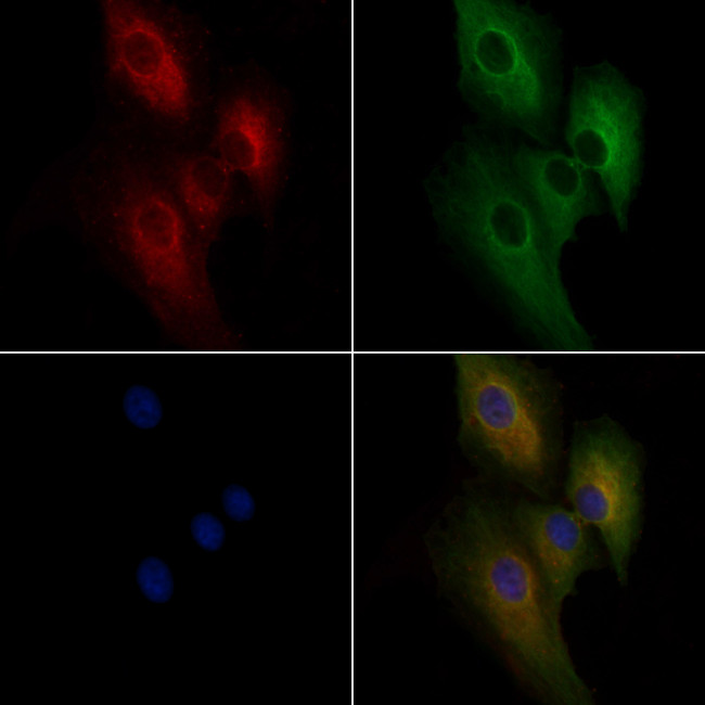 ABCA9 Antibody in Immunocytochemistry (ICC/IF)