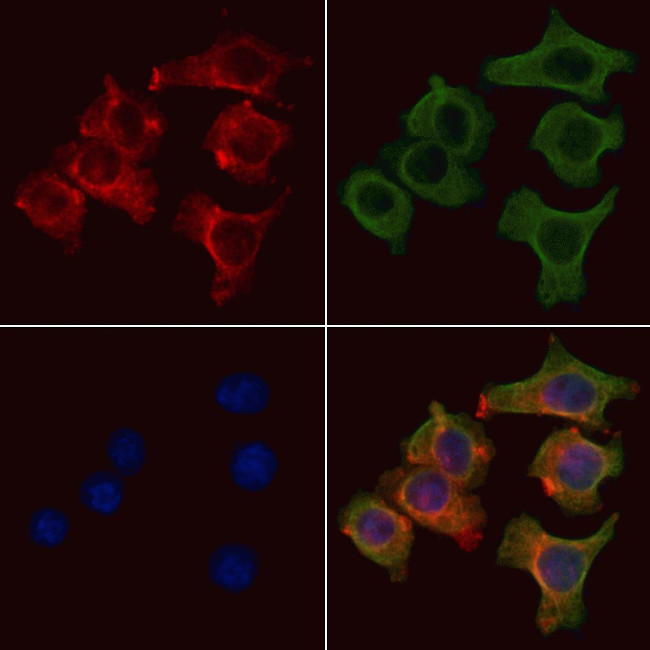 ABCF3 Antibody in Immunocytochemistry (ICC/IF)