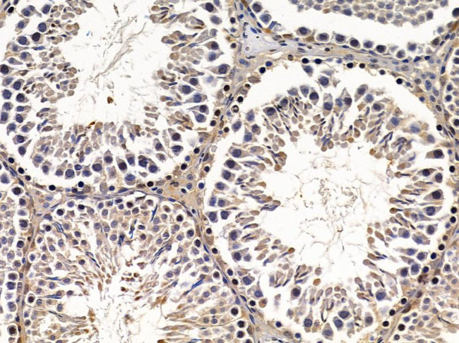 ABCC11 Antibody in Immunohistochemistry (Paraffin) (IHC (P))