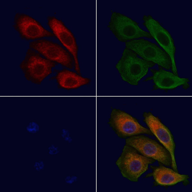 ABCC11 Antibody in Immunocytochemistry (ICC/IF)