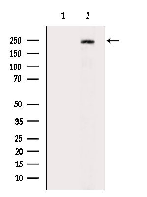 ABCC9 Antibody in Western Blot (WB)