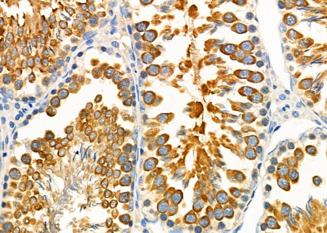 KCNJ14 Antibody in Immunohistochemistry (Paraffin) (IHC (P))