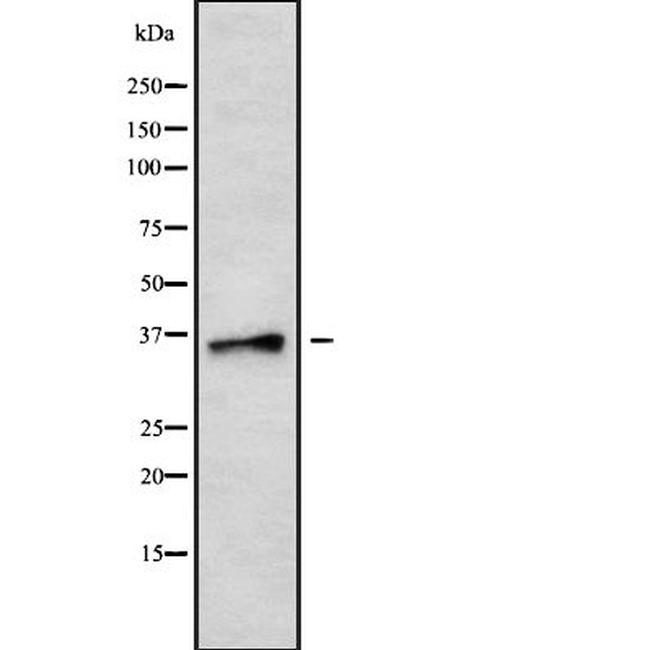 B3GALT5 Antibody in Western Blot (WB)