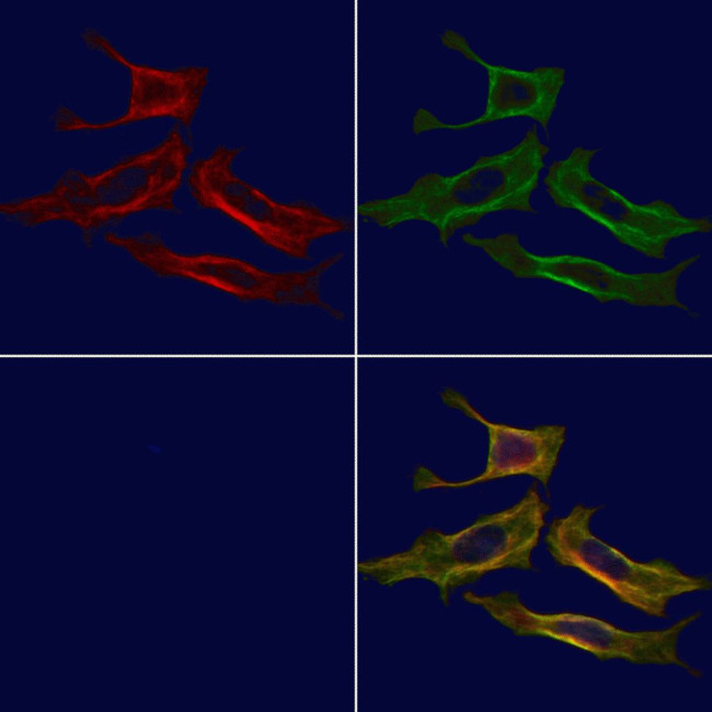 B3GALT6 Antibody in Immunocytochemistry (ICC/IF)