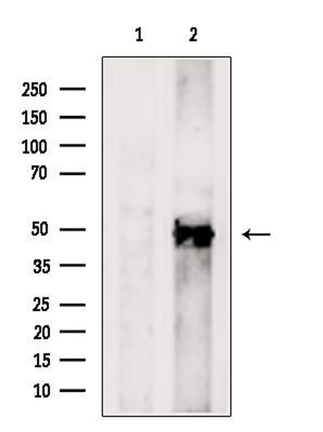 B4GALT6 Antibody in Western Blot (WB)