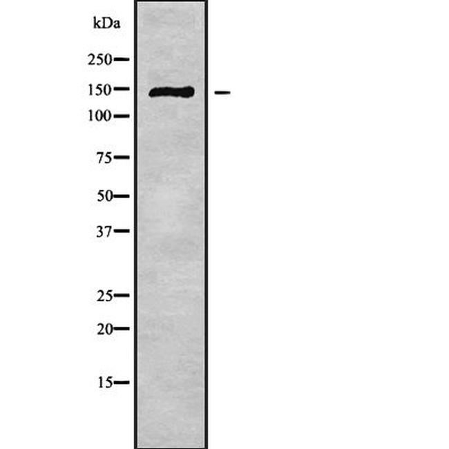 ABCB11 Antibody in Western Blot (WB)