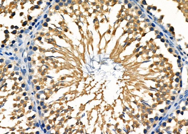 Bmp1 Antibody in Immunohistochemistry (Paraffin) (IHC (P))