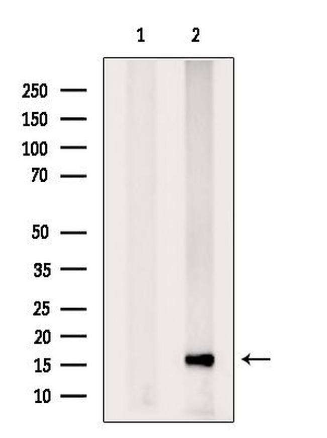 PPP3R1 Antibody in Western Blot (WB)