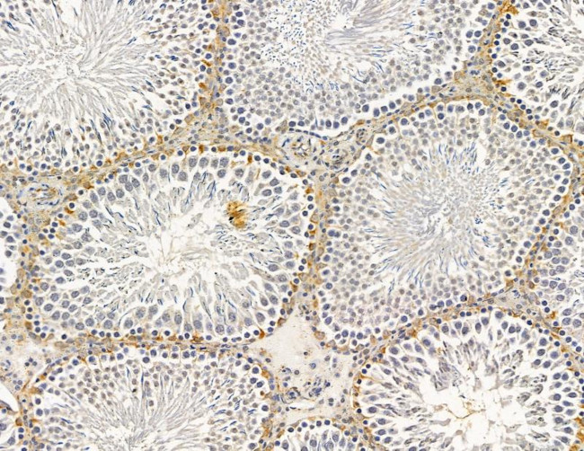 CAMLG Antibody in Immunohistochemistry (Paraffin) (IHC (P))