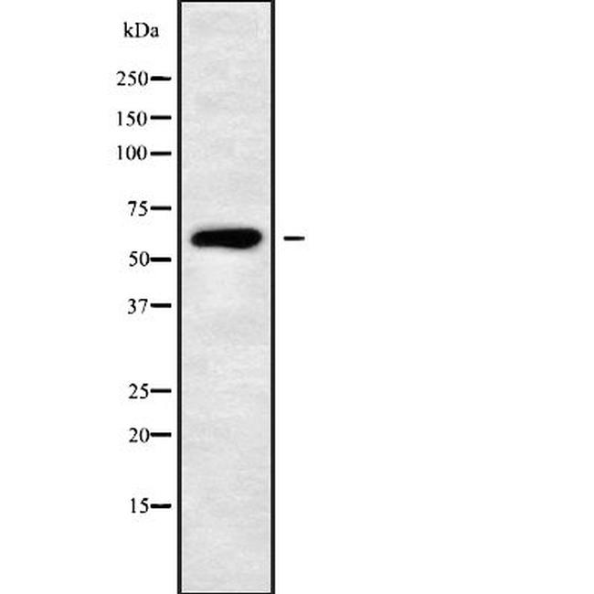 PDE1B Antibody in Western Blot (WB)