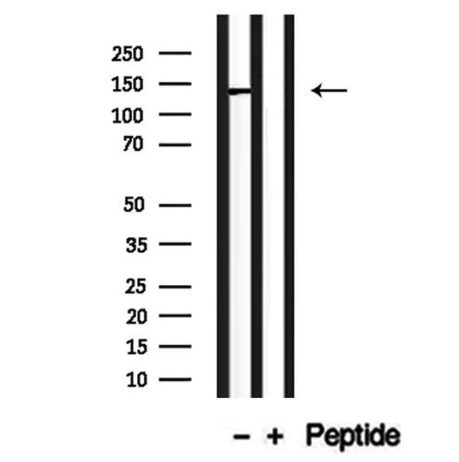 CADPS2 Antibody in Western Blot (WB)