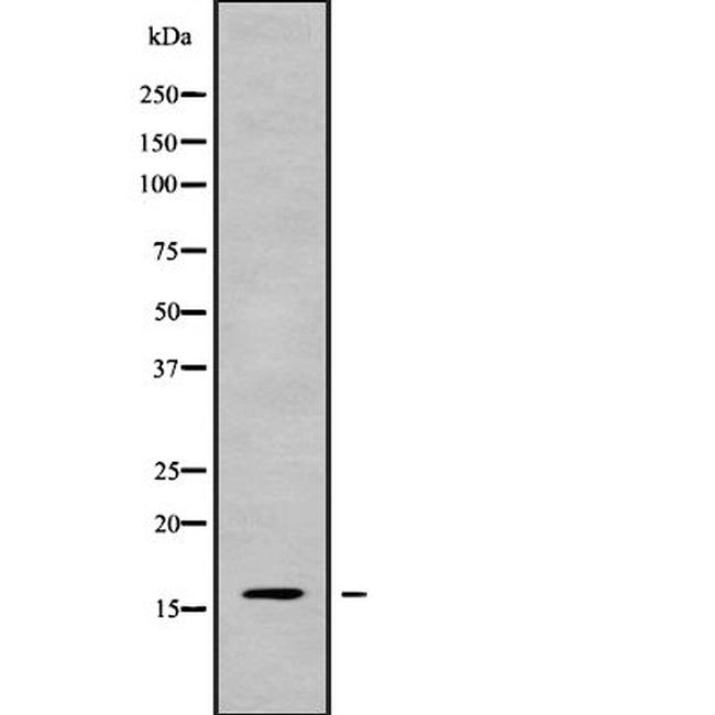 CALML5 Antibody in Western Blot (WB)