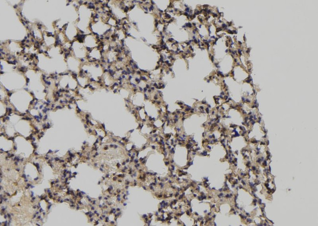 Calpain 3 Antibody in Immunohistochemistry (Paraffin) (IHC (P))