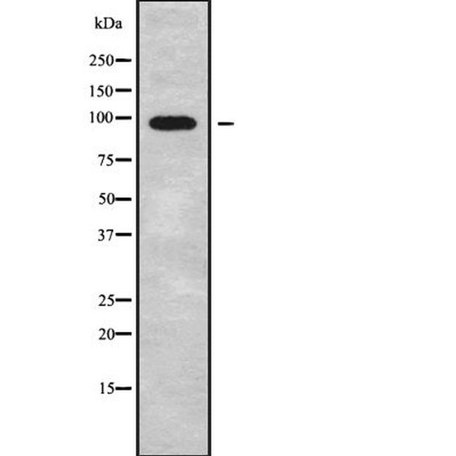 Calpain 7 Antibody in Western Blot (WB)