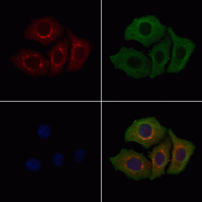 Calponin 3 Antibody in Immunocytochemistry (ICC/IF)