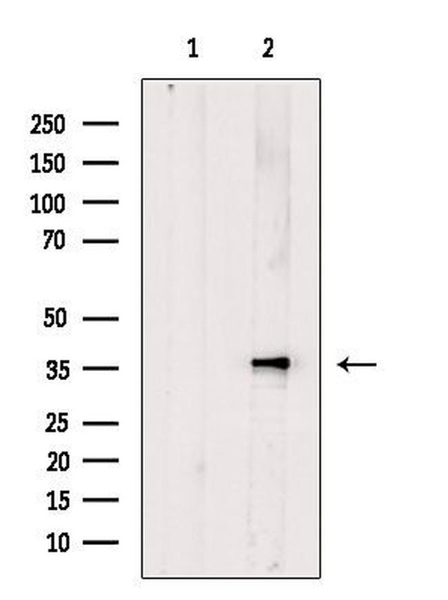 Calponin 3 Antibody in Western Blot (WB)