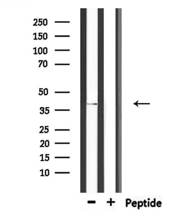 CHST11 Antibody in Western Blot (WB)