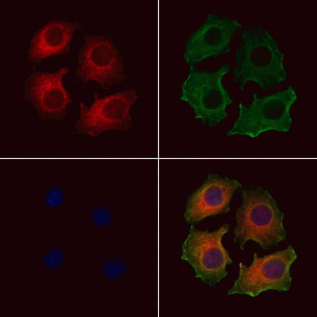 CHST14 Antibody in Immunocytochemistry (ICC/IF)