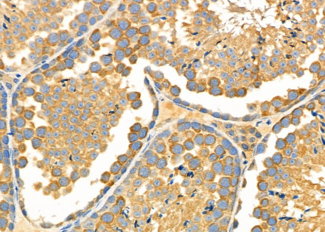 CHST14 Antibody in Immunohistochemistry (Paraffin) (IHC (P))